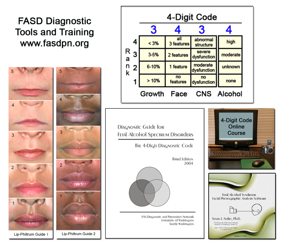 FASD diagnostic tools and training FASD diagnostic tools and training